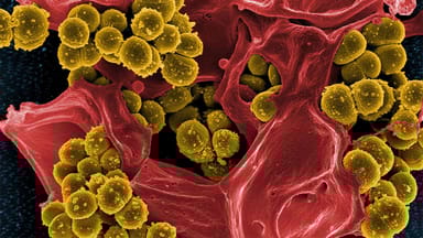Bacterias resistentes a antibióticos. Cada vez que toma antibióticos, las bacterias sensibles mueren. Crédito: NIAID