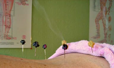 Imagen que ilustra la medicina complementaria y alternativa, destacando prácticas como acupuntura y quiropráctica.